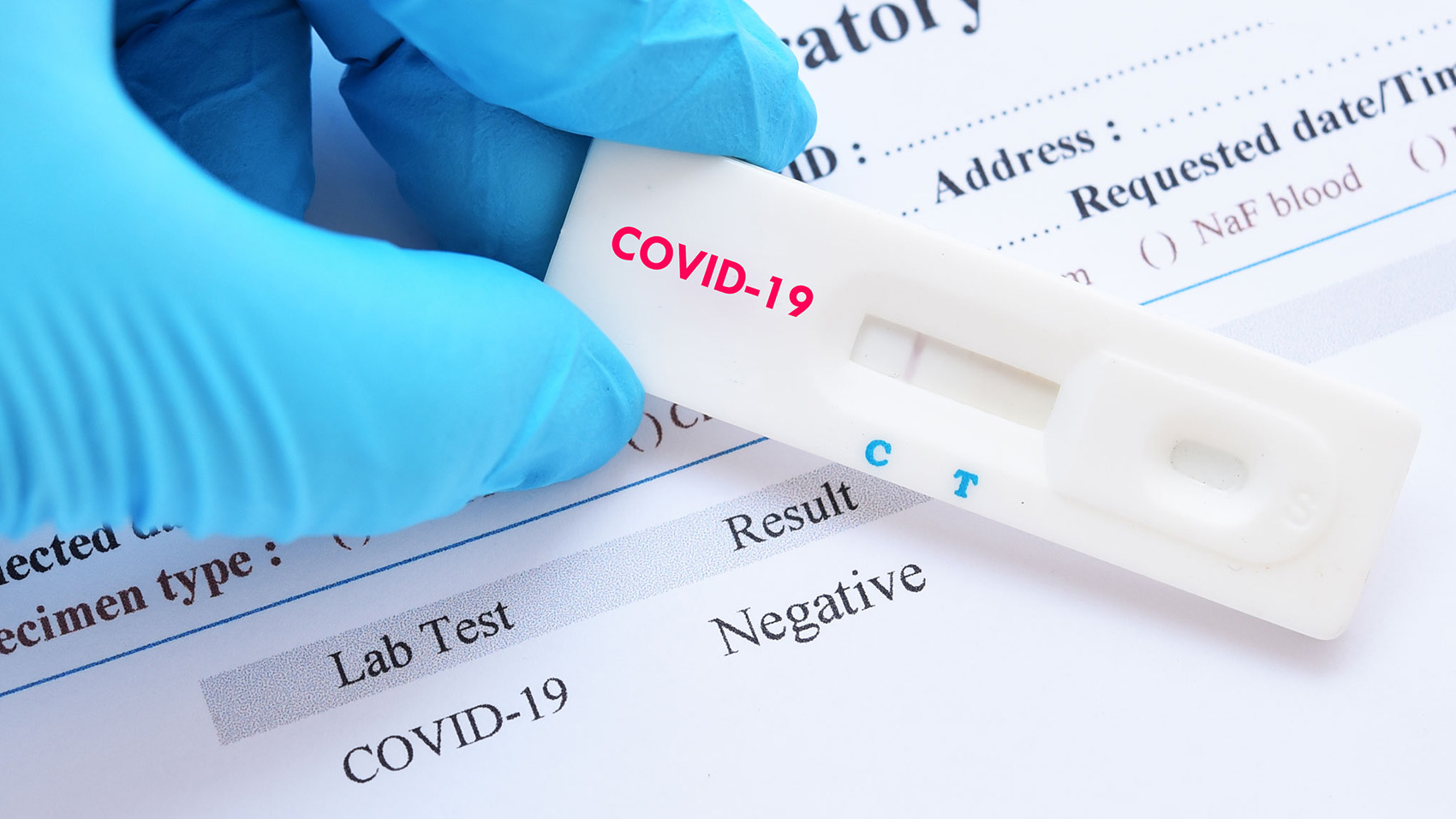 На Житомирщині зростає захворюваність на COVID-19 – майже пів тисячі нових випадків за тиждень